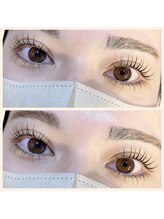 アトモス サニーテラス(Atmos sunny terrace)/上下まつぱ