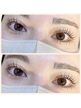 アトモス サニーテラス(Atmos sunny terrace)/上下まつぱ