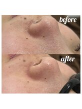 チル(chill)/ビフォーアフター♪