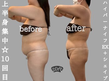 ソウソウビューティー 五反田(Shou Shou Beauty)/ビフォー★アフター