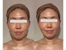 【小顔と眼精疲労ならコレ】頭まるごとスッキリ小顔コルギ60分7000円男女歓迎