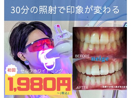 ネージュ(neige)の写真