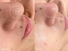 ミュー 栄本店(mieux)/お客様Before/After