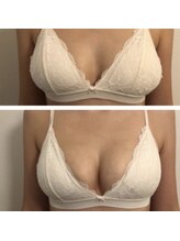 キラリア(Kiraria)/施術イメージ