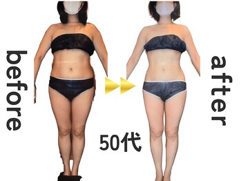 ジュリアン(Julien)/【お客様結果写真】[麹町/痩身]