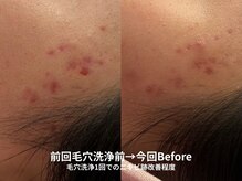 ピブ(pib.)/お悩みに合わせたケアを