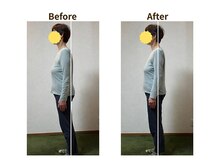 フェルナ(FERNA)/Before/After