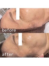 サロン リティナ(Salon Ritina)/“シワ“深くなる前に予防が大事