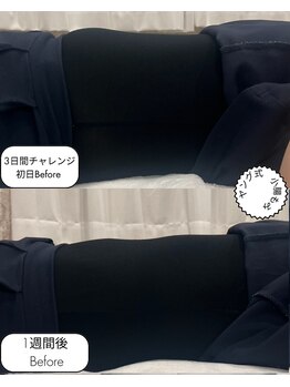 ネシア(nesia)/ヤング式腸揉み(20分)