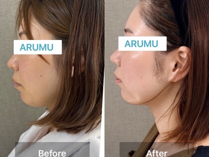 アルム コリア(ARUMU KOREA)の写真