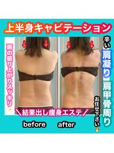 ビューティ ウィッチ(Beauty Witch)/肩凝り解消も◎