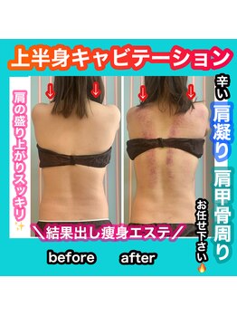 ビューティ ウィッチ(Beauty Witch)/肩凝り解消も◎