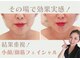 リベルテ(Liberte)の写真