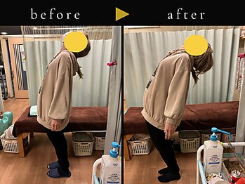 杉本接骨鍼灸院/テニスができるようになりました