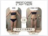 【最新人気No.1】水素スピード痩せ90分ダウンタイムなし/痩身/小顔/毛穴/美肌