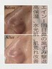 【清潔肌セット】鼻の毛穴洗浄＋顔脱毛(首含む)1回通常¥12100→¥8500