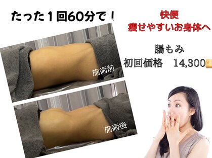 リア(Lia)の写真