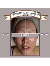 ビーマジック(美magic)/サーマトリックス