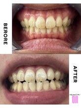 エクシアホワイトニング 王寺店/