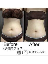 リラクゼーションルーム チュラ(Relaxation Room CERAH)/深部加温ラフォスプレミアム