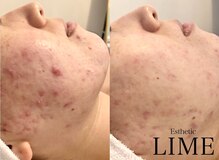 ライム 西船橋(LIME)