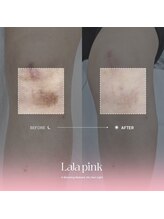 グラッソ(GRASSO)/ララピンク