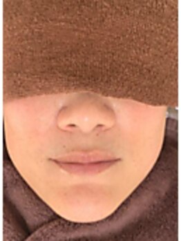 美白ケアをしたい