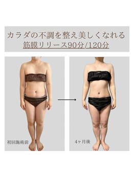 ソルヴィス 根本(soLvis)/沼る筋膜リリース