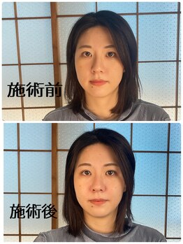 快眠ドライヘッドマッサージ専門店 ひつじ/《施術前と施術後》