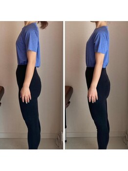 ザ エスアップ 博多店(THE S-UP)/施術前後写真