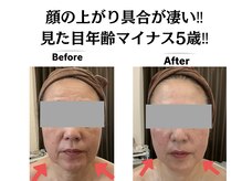 グレースティー 森町 箕面/顔がグイグイリフトアップ！