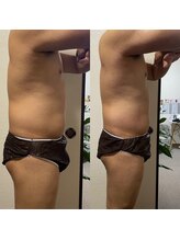 ティグレ 岡山店(TIGRE)/メンズ全身痩身エステ