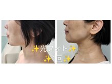 ラヴィールサロン 川原町店/50代　光フォト体験