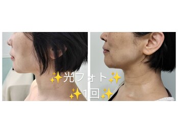 ラヴィールサロン 川原町店/50代　光フォト体験