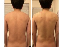 リクラ 北千住(Reclat)/姿勢改善　背中引き締め1回