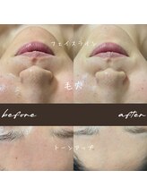 ダオン(Daon)/1回でしっかりと結果を出します