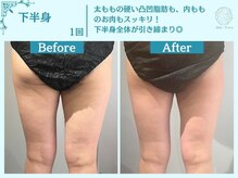 フローフシ∞/【痩身】下半身・お尻の脂肪撃退