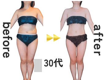 ジュリアン(Julien)/【お客様結果写真】[麹町/痩身]