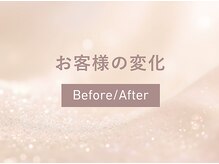 エヴァル(ewalu)/月１～２回のケアがオススメ★