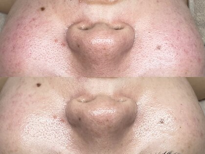 キヌ(KINU)の写真