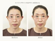 インヤン美容鍼 鍼灸治療院 湘南藤沢院