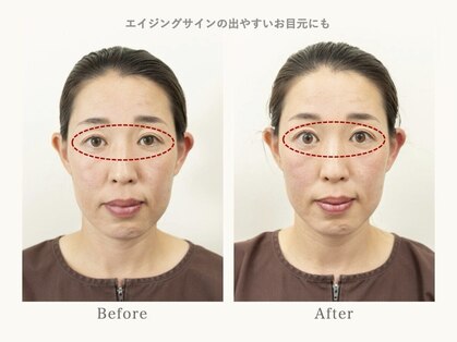 インヤン美容鍼 鍼灸治療院 湘南藤沢院の写真
