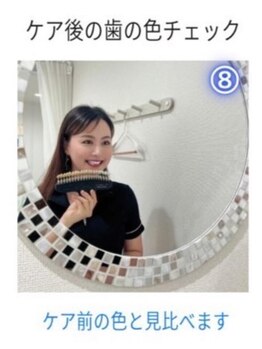 ホワイトニングショップ 三島店(WHITENING SHOP)/【ホワイトニングの流れ】８