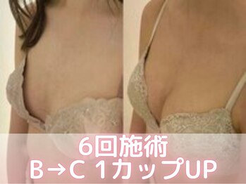 美人バスト 横浜店/バストアップ/育乳(6回施術)