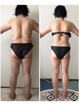 すばる整体院 小牧/エステ機結果/小牧/産後骨盤