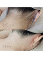 リリィ(Riliy)&nbsp;☆うなじWAX☆首が長く見える効果があり、涼し気な印象に♪
