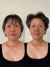 こつこつラボ サンイチマル オオル(310/OOL')&nbsp;施術 美容整体