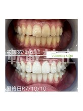 ホワイトニングサロン 札幌店/【ホワイトニング】#札幌#大通り