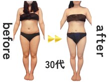 ジュリアン(Julien)/【お客様結果写真】[麹町/痩身]