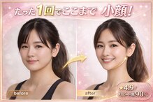 レビーリズ(Revie Liz)